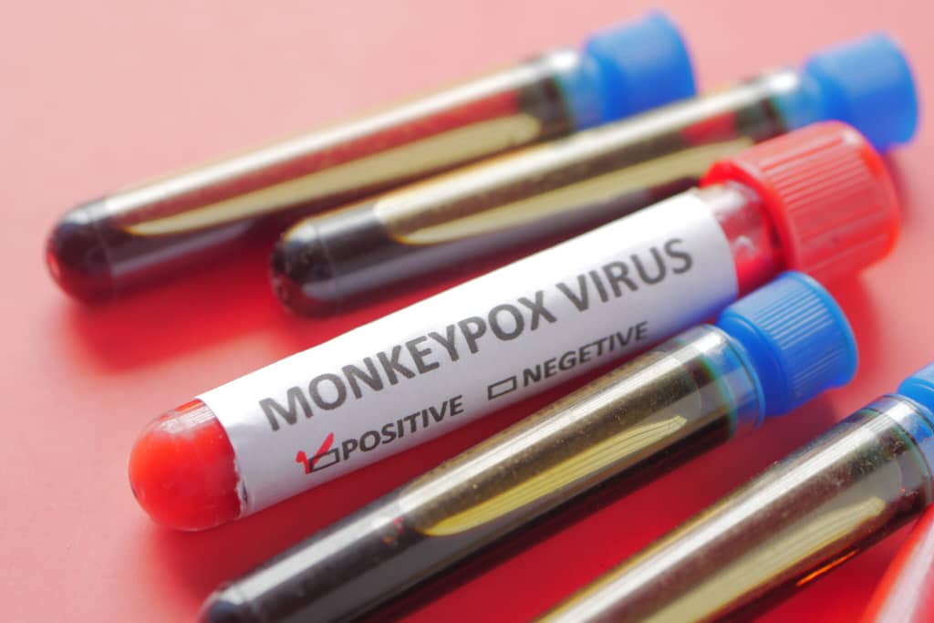 WHO ramal varian wabak mpox lebih berbahaya