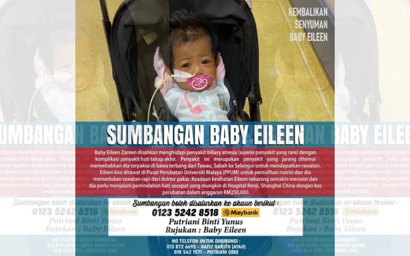 Bayi 8 bulan hidap komplikasi hati perlu RM250,000