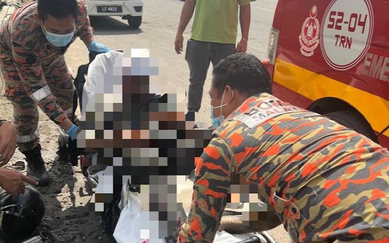 Lelaki patah kaki kanan kemalangan motosikal