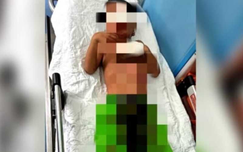 Kanak-kanak Pasti jadi mangsa pertama mercun di Kedah, putus jari telunjuk