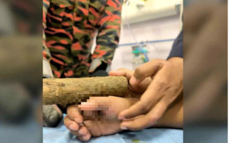 Budak 6 tahun tertusuk paku, bomba bantu potong kayu