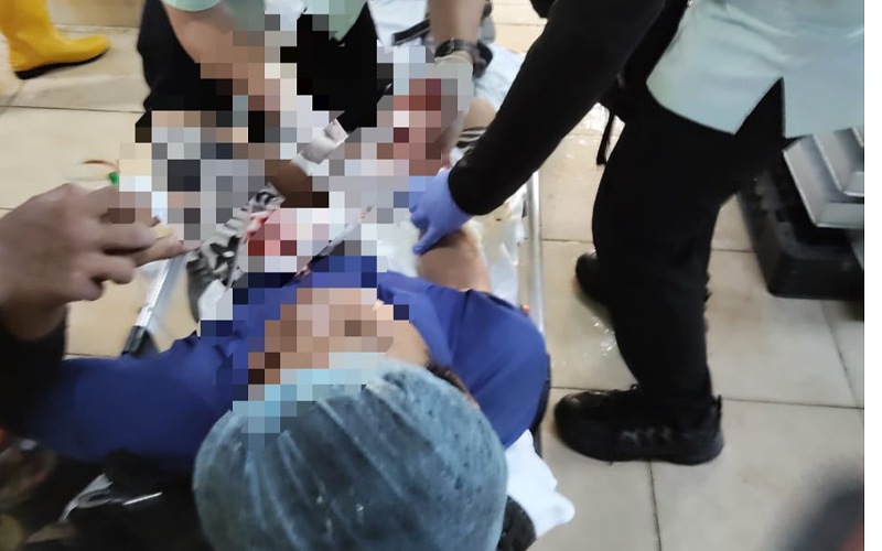 Kerja mengisar ikan bertukar tragedi, jari lelaki tersepit mesin